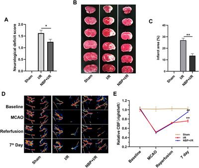 DL-3-n-butylphthalide (NBP) alleviates poststroke cognitive impairment (PSCI) by suppressing neuroinflammation and oxidative stress